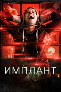 <h1>Имплант</h1>